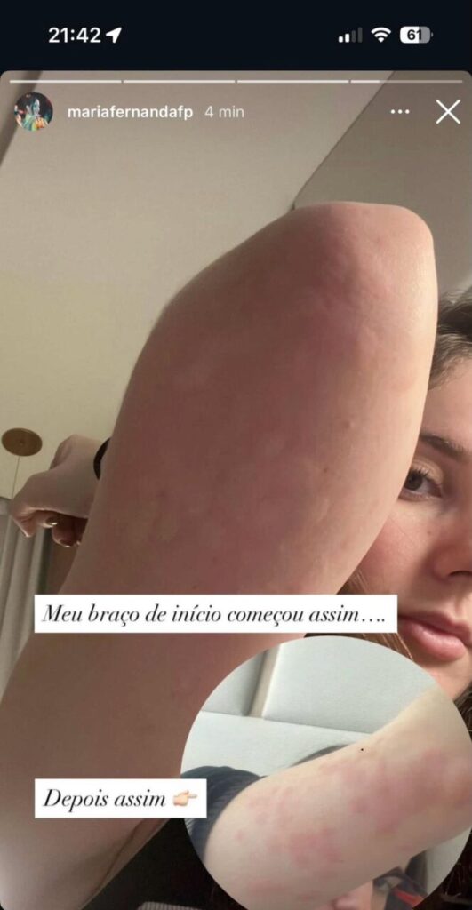 percevejos 12