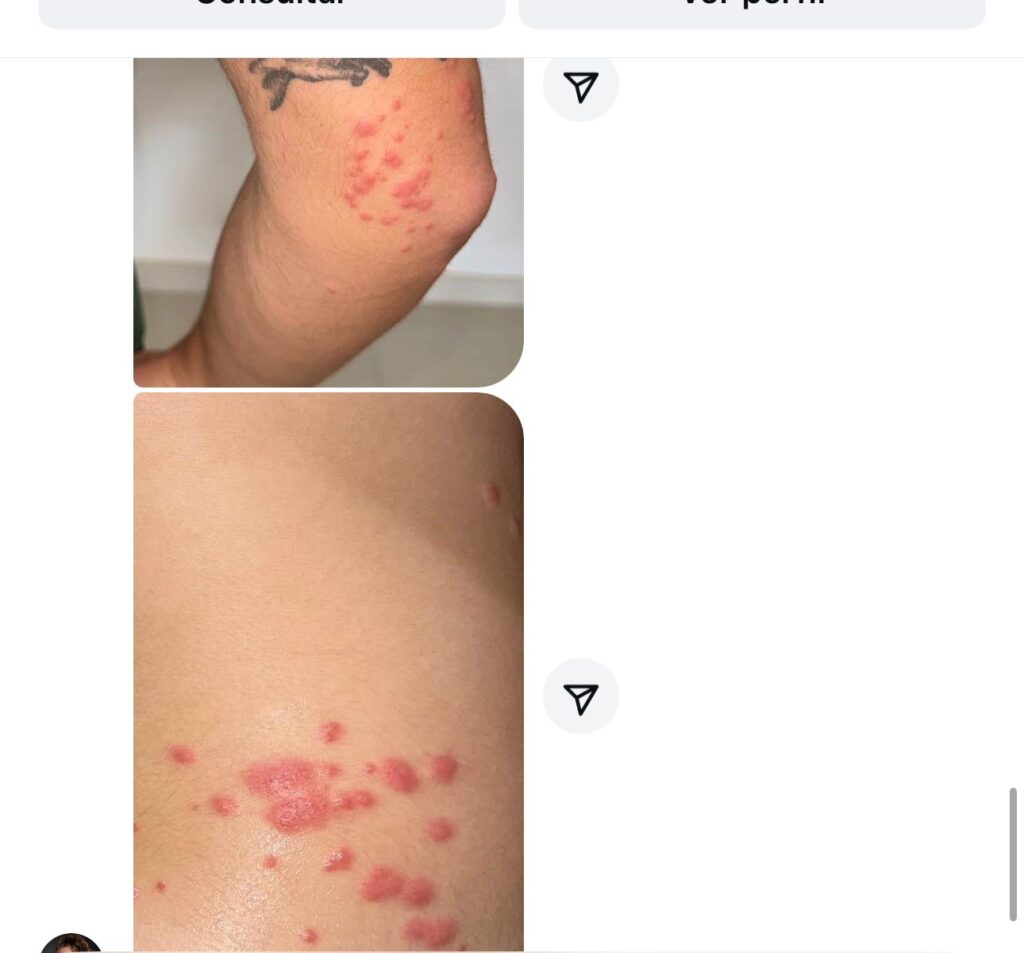 percevejos 4